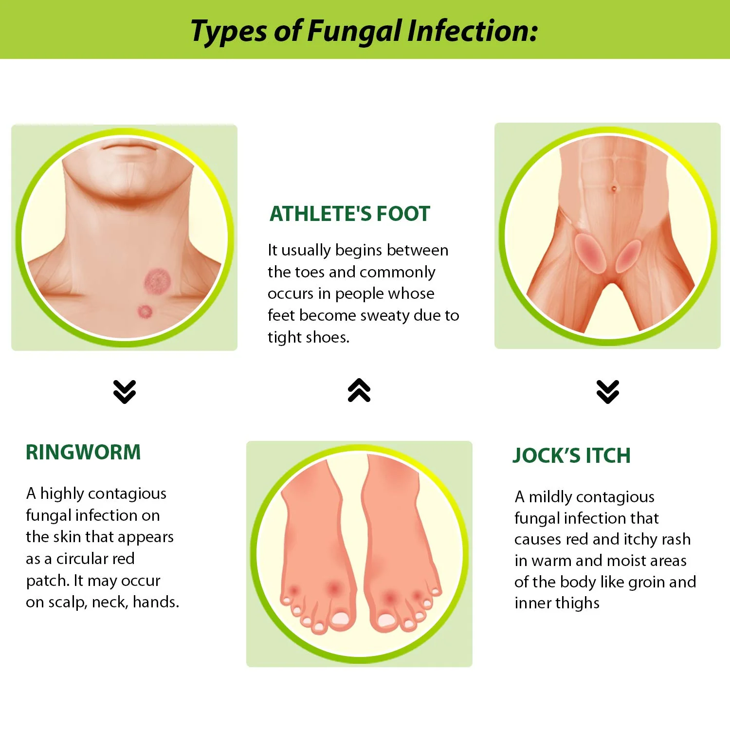 Tetmosol Antifungal Dusting Powder | Fights Skin Infections - 100 gm - Image 4